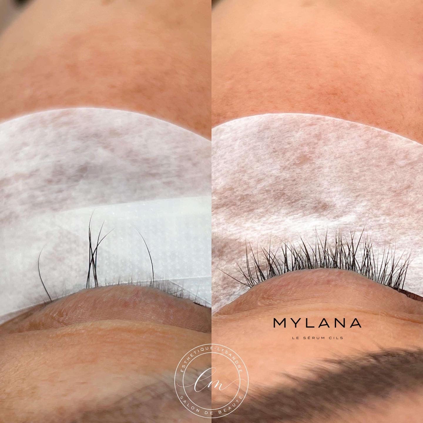 MYLANA LASH SERUM 