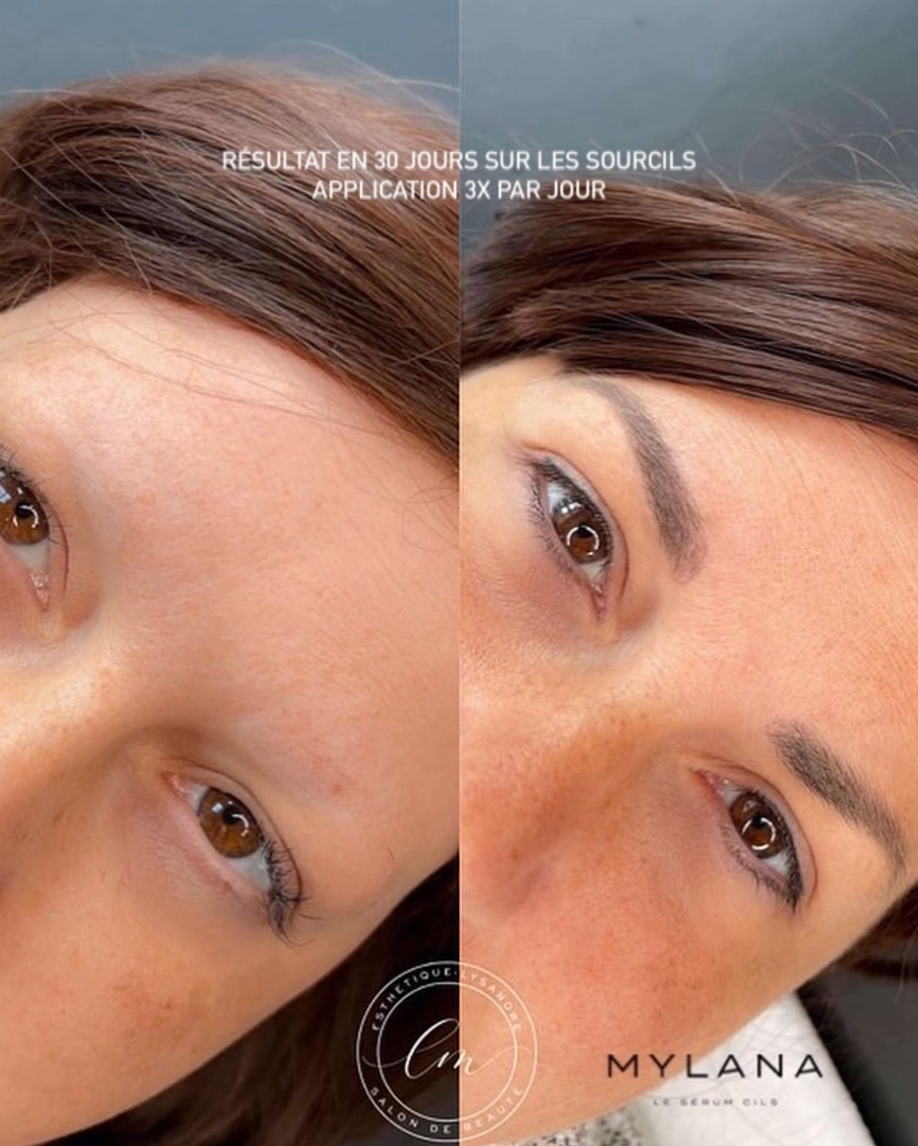 MYLANA LASH SERUM 